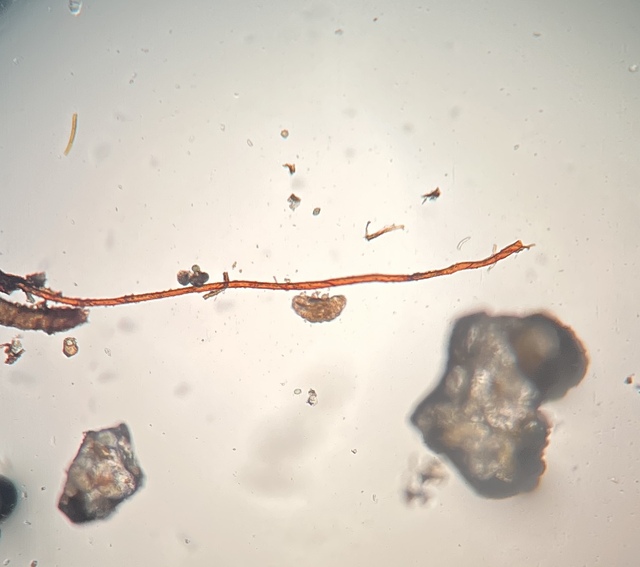 IMG_2660クマムシ kumamusi